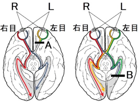 視交叉城郭